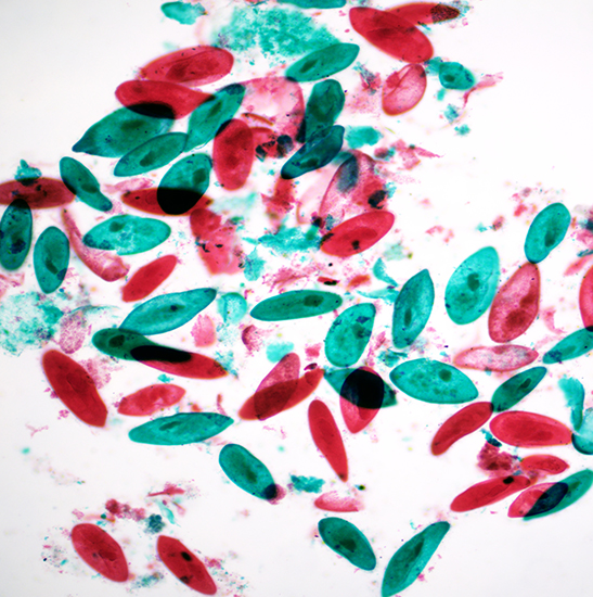 BestScope BS-2081 Research Biological Microscope - Image 4