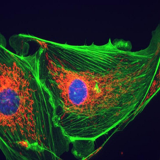 BestScope BS-2036FB(LED) Fluorescent Binocular Biological - Image 3